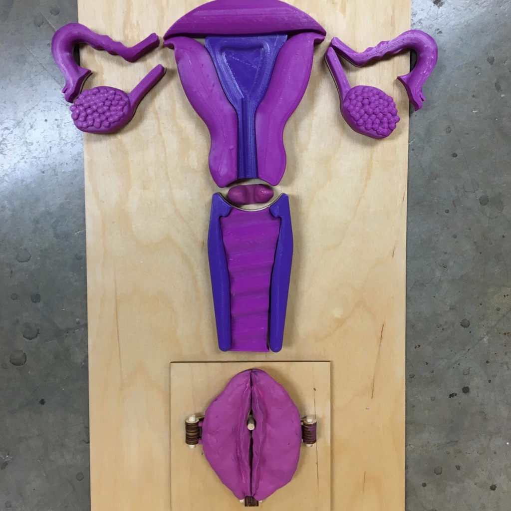 A second stage 3D printed prototype of the uterus